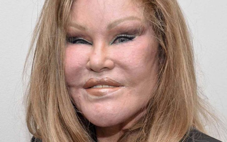 Who Is Jocelyn Wildenstein? Find Out More About Her Age, Wiki, Bio, Movies, Show, Surgery, And More
