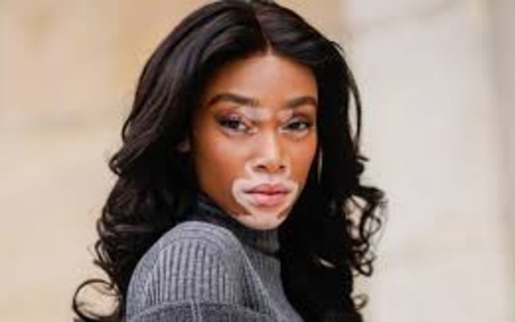 Who Is Winnie Harlow? Here's All You Need To Know About Her Age, Height, Body Measurements, Net Worth, Career, And Relationship