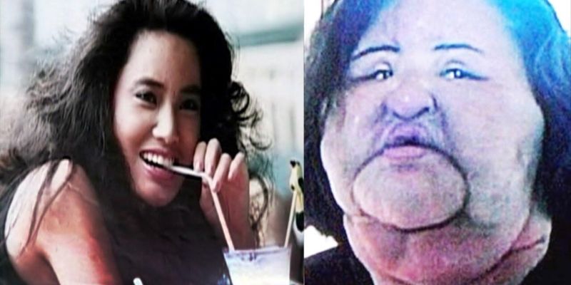 Korean Model Hang Mioku's Plastic Surgery Obsession Will Surprise You!!